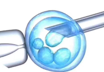 26岁做试管几率有多高